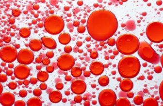 Anemia Comprehensive Guide